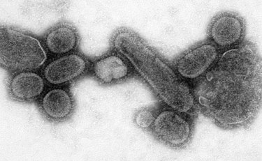 인플루엔자 A 바이러스 서브타입 H1N1 현미경 사진.
